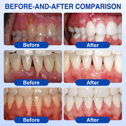 🇨🇦🥇👨‍⚕️🦷🛡️𝑬𝒅𝒊𝑱𝒐𝒏𝒂𝒉® GumRevive periodontal repair gel