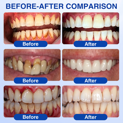 🇨🇦🥇👨‍⚕️🦷🛡️𝑬𝒅𝒊𝑱𝒐𝒏𝒂𝒉® GumRevive periodontal repair gel