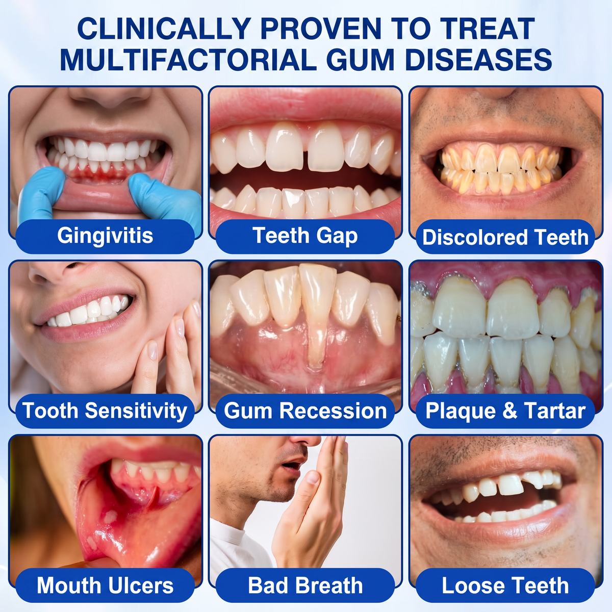 🇨🇦🥇👨‍⚕️🦷🛡️𝑬𝒅𝒊𝑱𝒐𝒏𝒂𝒉® GumRevive periodontal repair gel