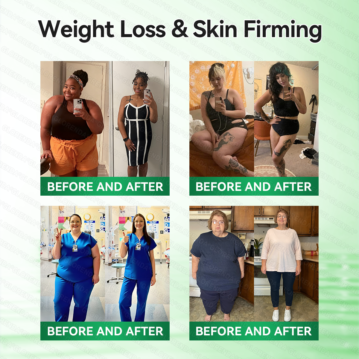 𝑶𝒇𝒇𝒊𝒄𝒊𝒂𝒍 𝑺𝒕𝒐𝒓𝒆 | 𝐆𝑳𝑶𝗥𝗘𝗡𝘿𝘼® 𝙈𝒐𝒓𝒊𝒏𝒈𝗮 · 𝗕𝗲𝗿𝗯𝐞𝐫𝐢𝐧𝙚 × 𝙉𝑨𝑫+ 𝟏𝟎-𝙞𝙣-𝟏 𝘼𝒅𝒗𝒂𝒏𝒄𝒆𝐝 𝐍𝐚𝐧𝙤 𝙈𝙞𝙘𝙧𝙤𝙣𝒆𝒆𝒅𝒍𝐞 𝐏𝐚𝐭𝙘𝙝🍁🍁(𝐉𝐮𝐬𝐭 𝐨𝐧𝐜𝐞 𝐚 𝐝𝐚𝐲, 𝐯𝐢𝐬𝐢𝐛𝐥𝐞 𝐜𝐡𝐚𝐧𝐠𝐞𝐬 𝐢𝐧 𝟕 𝐝𝐚𝐲𝐬） ✅ 𝐅𝐨𝐫 𝐨𝐛𝐞𝐬𝐢𝐭𝐲, 🅛🅞🅞🅢🅔 🅢🅚🅘🅝,𝐝𝐢𝐚𝐛𝐞𝐭𝐞𝐬, 𝐬𝐥𝐞𝐞𝐩 𝐚𝐩𝐧𝐞𝐚, 𝐣𝐨𝐢𝐧𝐭 𝐢𝐬𝐬𝐮𝐞𝐬, 𝐚𝐧𝐝 𝐦𝐨𝐫𝐞