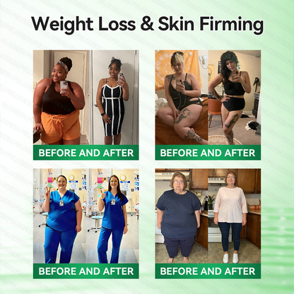 𝑶𝒇𝒇𝒊𝒄𝒊𝒂𝒍 𝑺𝒕𝒐𝒓𝒆 | 𝐆𝑳𝑶𝗥𝗘𝗡𝘿𝘼® 𝙈𝒐𝒓𝒊𝒏𝒈𝗮 · 𝗕𝗲𝗿𝗯𝐞𝐫𝐢𝐧𝙚 × 𝙉𝑨𝑫+ 𝟏𝟎-𝙞𝙣-𝟏 𝘼𝒅𝒗𝒂𝒏𝒄𝒆𝐝 𝐍𝐚𝐧𝙤 𝙈𝙞𝙘𝙧𝙤𝙣𝒆𝒆𝒅𝒍𝐞 𝐏𝐚𝐭𝙘𝙝🍁🍁(𝐉𝐮𝐬𝐭 𝐨𝐧𝐜𝐞 𝐚 𝐝𝐚𝐲, 𝐯𝐢𝐬𝐢𝐛𝐥𝐞 𝐜𝐡𝐚𝐧𝐠𝐞𝐬 𝐢𝐧 𝟕 𝐝𝐚𝐲𝐬） ✅ 𝐅𝐨𝐫 𝐨𝐛𝐞𝐬𝐢𝐭𝐲, 🅛🅞🅞🅢🅔 🅢🅚🅘🅝,𝐝𝐢𝐚𝐛𝐞𝐭𝐞𝐬, 𝐬𝐥𝐞𝐞𝐩 𝐚𝐩𝐧𝐞𝐚, 𝐣𝐨𝐢𝐧𝐭 𝐢𝐬𝐬𝐮𝐞𝐬, 𝐚𝐧𝐝 𝐦𝐨𝐫𝐞