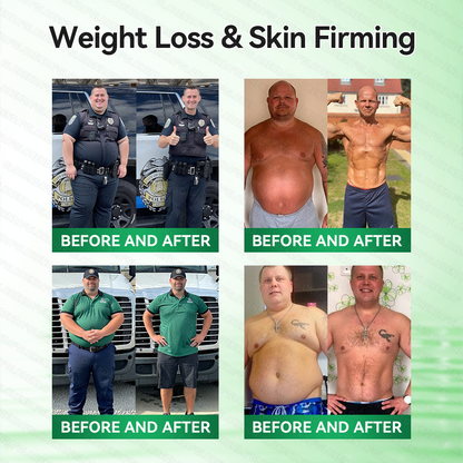𝑶𝒇𝒇𝒊𝒄𝒊𝒂𝒍 𝑺𝒕𝒐𝒓𝒆 | 𝐆𝑳𝑶𝗥𝗘𝗡𝘿𝘼® 𝙈𝒐𝒓𝒊𝒏𝒈𝗮 · 𝗕𝗲𝗿𝗯𝐞𝐫𝐢𝐧𝙚 × 𝙉𝑨𝑫+ 𝟏𝟎-𝙞𝙣-𝟏 𝘼𝒅𝒗𝒂𝒏𝒄𝒆𝐝 𝐍𝐚𝐧𝙤 𝙈𝙞𝙘𝙧𝙤𝙣𝒆𝒆𝒅𝒍𝐞 𝐏𝐚𝐭𝙘𝙝🍁🍁(𝐉𝐮𝐬𝐭 𝐨𝐧𝐜𝐞 𝐚 𝐝𝐚𝐲, 𝐯𝐢𝐬𝐢𝐛𝐥𝐞 𝐜𝐡𝐚𝐧𝐠𝐞𝐬 𝐢𝐧 𝟕 𝐝𝐚𝐲𝐬） ✅ 𝐅𝐨𝐫 𝐨𝐛𝐞𝐬𝐢𝐭𝐲, 🅛🅞🅞🅢🅔 🅢🅚🅘🅝,𝐝𝐢𝐚𝐛𝐞𝐭𝐞𝐬, 𝐬𝐥𝐞𝐞𝐩 𝐚𝐩𝐧𝐞𝐚, 𝐣𝐨𝐢𝐧𝐭 𝐢𝐬𝐬𝐮𝐞𝐬, 𝐚𝐧𝐝 𝐦𝐨𝐫𝐞
