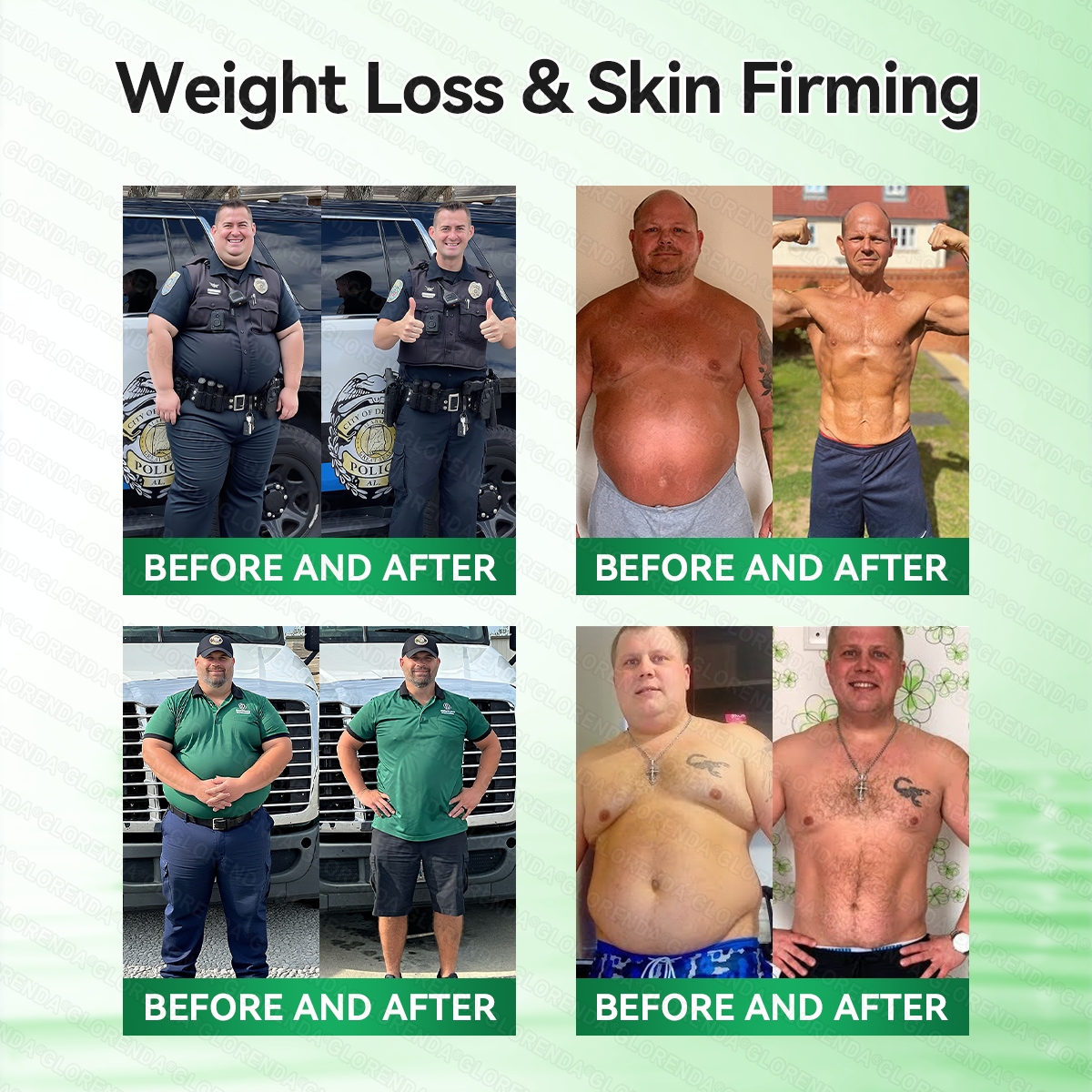 𝑶𝒇𝒇𝒊𝒄𝒊𝒂𝒍 𝑺𝒕𝒐𝒓𝒆 | 𝐆𝑳𝑶𝗥𝗘𝗡𝘿𝘼® 𝙈𝒐𝒓𝒊𝒏𝒈𝗮 · 𝗕𝗲𝗿𝗯𝐞𝐫𝐢𝐧𝙚 × 𝙉𝑨𝑫+ 𝟏𝟎-𝙞𝙣-𝟏 𝘼𝒅𝒗𝒂𝒏𝒄𝒆𝐝 𝐍𝐚𝐧𝙤 𝙈𝙞𝙘𝙧𝙤𝙣𝒆𝒆𝒅𝒍𝐞 𝐏𝐚𝐭𝙘𝙝🔥🎁(𝐉𝐮𝐬𝐭 𝐨𝐧𝐜𝐞 𝐚 𝐝𝐚𝐲, 𝐯𝐢𝐬𝐢𝐛𝐥𝐞 𝐜𝐡𝐚𝐧𝐠𝐞𝐬 𝐢𝐧 𝟕 𝐝𝐚𝐲𝐬） ✅ 𝐅𝐨𝐫 𝐨𝐛𝐞𝐬𝐢𝐭𝐲, 🅛🅞🅞🅢🅔 🅢🅚🅘🅝,𝐝𝐢𝐚𝐛𝐞𝐭𝐞𝐬, 𝐬𝐥𝐞𝐞𝐩 𝐚𝐩𝐧𝐞𝐚, 𝐣𝐨𝐢𝐧𝐭 𝐢𝐬𝐬𝐮𝐞𝐬, 𝐚𝐧𝐝 𝐦𝐨𝐫𝐞