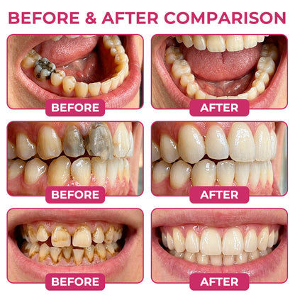 𝑬𝒅𝒊𝑱𝒐𝒏𝒂𝒉® 𝑫𝒆𝒏𝑷𝒆𝒓𝒎 – 𝑵𝒂𝒕𝒖𝒓𝒂𝒍 𝑬𝒏𝒂𝒎𝒆𝒍 𝑭𝒊𝒍𝒍𝒊𝒏𝒈 𝑮𝒆𝒍 𝒇𝒐𝒓 𝑪𝒂𝒗𝒊𝒕𝒚 𝑹𝒆𝒑𝒂𝒊𝒓